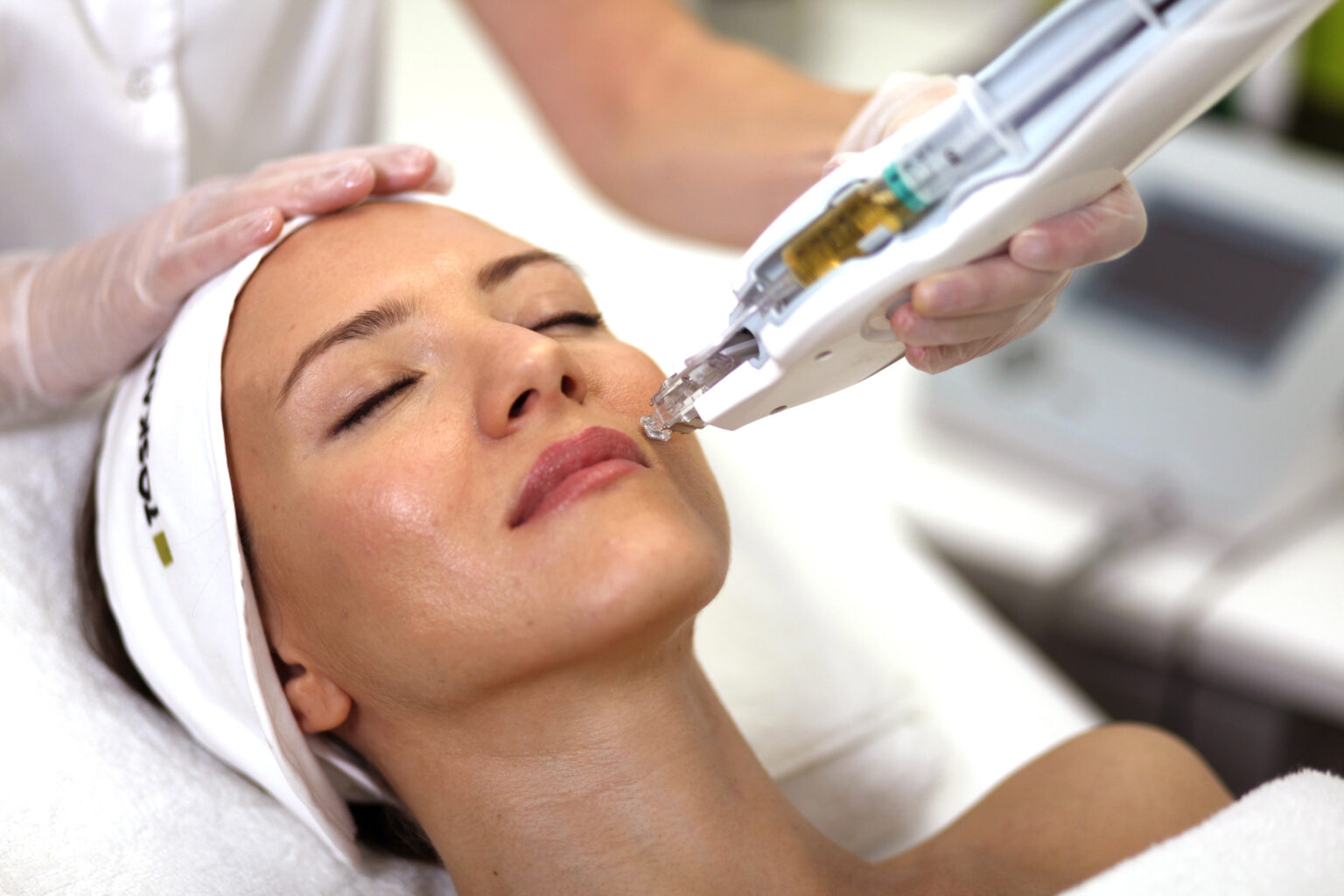 Microneedling